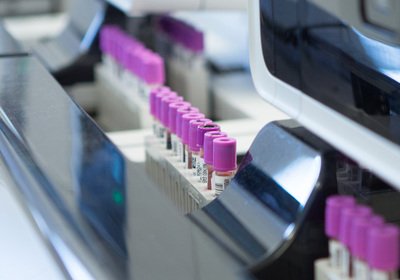 Depistage VIH gratuit