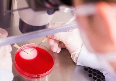 Assistance Médicale à la Procréation (AMP)